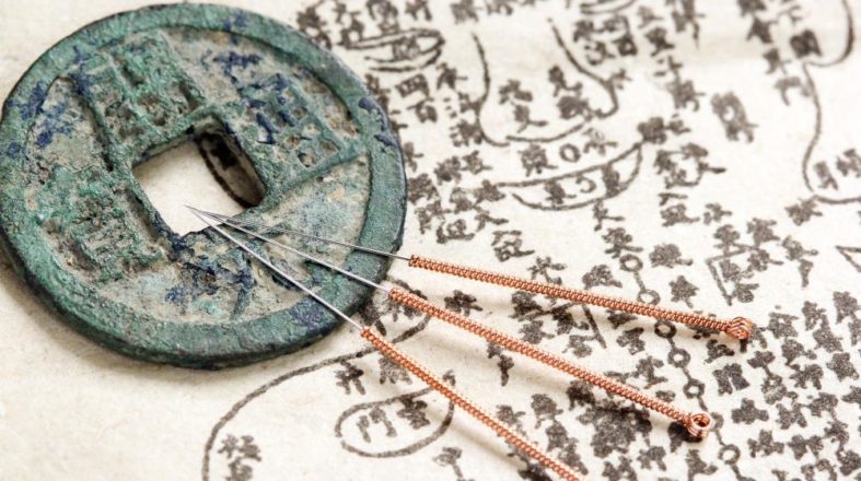 Akupunktur – Traditionelle Chinesische Medizin gegen Warzen?